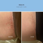 Fruit Acid Scrub Factory - Dark Spot Exfoliating Soften