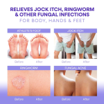 Antibacterial Soap Supplier - Private Label Lavender Tea Tree Anti Acne