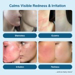 Hypochlorous Spray Manufacturer - 0.015% Sensitive Skin Safe