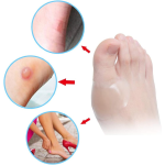 Hydrocolloid Wound Dressing Manufacturer - Self-adhesive Waterproof Bed Sore Care