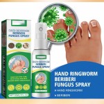 South Moon Gentle Herbal Formula Antifungal Hand and Foot Care Spray 30ML for Ringworm Beriberi Fungus Treatment
