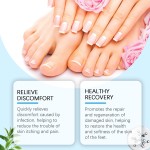 South Moon Wholesale Deep Nourishing Care for Health Gentle Cleaning Soothing Anti Infection Nail Care Ointment