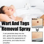 Wholesale Bee Venom Body Care Spray Effective Cure for Warts Moles and Desalination for Body Treatment