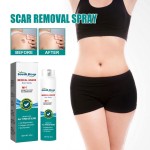 South Moon Fade Scar Pregnancy Surgery Smooth Skin Spray Body Care 20g