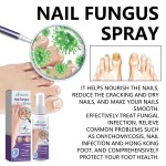XIMONTH Nail Care Soothing Repairing Natural Nail Fungus Treatment Serum Spray 100ml