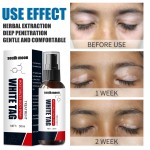 South Moon Vitiligo Spray Moisturizing White Spots Leukoplakia Disease Pigment Melanin White Tag Care
