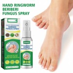 South Moon Gentle Herbal Formula Antifungal Hand and Foot Care Spray 30ML for Ringworm Beriberi Fungus Treatment
