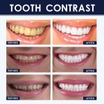 Wholesale EELHOE Teeth Cleaning Brightening Whitening Teeth Stains Removal Fresh Mouth Home Use Convenient Tooth Whitening