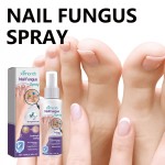 XIMONTH Nail Care Soothing Repairing Natural Nail Fungus Treatment Serum Spray 100ml