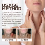 South Moon OEM Lymphatic Repair Cream Relieve Neck and Armpit Lymphatic Swelling Discomfort Body Health Care Patch