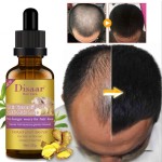 Hair Growth Serum Factory - OEM Private Label Plant Herbal Ginseng Biotin