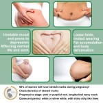 Stretch Mark Serum Supplier - Rose Removes Postpartum Obesity Repair