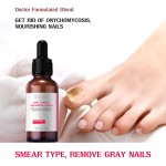 Nail Repair Essence Manufacturer - Sample+OEM/ODM Foot Fungus Treatment
