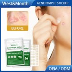 Acne Patch Factory - West&Month Acne Pimple Remover Waterproof Stickers