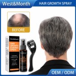 Hair Growth Spray Manufacturer - Hot Sale Natural Anti Hair Loss Men