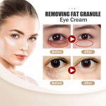 Eye Cream Manufacturer - EELHOE Improves Fine Lines Tightens Eye Bags