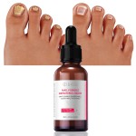 Nail Repair Essence Manufacturer - Sample+OEM/ODM Foot Fungus Treatment