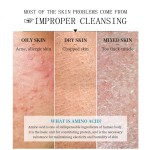 Facial Cleanser Supplier - for Sensitive Acne Oil Control Korean Skin