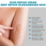 Scar Removal Cream Factory - West&Month Oem Scar Removal Pimples Marks