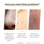 Handmade Soap Factory - Anti Acne Dark Spots Removal Ginger Turmeric