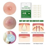 Acne Patch Factory - West&Month Acne Pimple Remover Waterproof Stickers