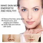 Whitening Cream Manufacturer - Best Seller Moisturizing Oil Control Spot