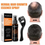 Hair Growth Spray Manufacturer - Hot Sale Natural Anti Hair Loss Men