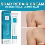 Scar Removal Cream Factory - West&Month Oem Scar Removal Pimples Marks