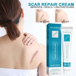 Scar Removal Cream Factory - West&Month Oem Scar Removal Pimples Marks