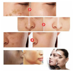 Vitamin C Capsules Supplier - Private Label Skin Whitening Supplement