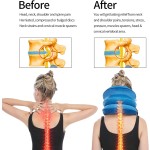 Cervical Traction Device Factory - Air Inflatable Neck Support Equipment