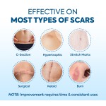 Silicone Gel Strips Manufacturer - Hot Sale 1.5m Scar Removal OEM