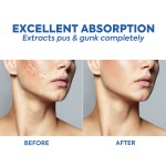 Acne Pimple Patch Manufacturer - Invisible Blemish Hydrocolloid Healing