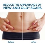 Silicone Scar Sheets Manufacturer - Professional Safe Effective Body Care