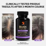 Biotin Collagen Keratin Supplement Supplier - 25000mcg Hyaluronic Acid