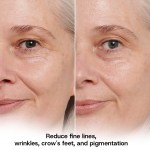 Multi Collagen Pills Manufacturer - Hydrolyzed Peptides