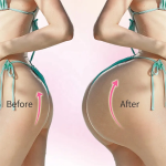 Women Supplement Tea Factory - Hip Enlargement Firming