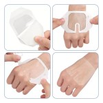 Transparent Dressing Factory - PU Waterproof Wound Dressing Adhesive Patch IV