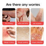 Psoriasis Ointment Factory - Herbal Formula Deep Repair Itching Relief