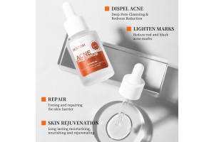 Acne Essence: Leading Global Brand Private Label Manufacturing (OEM/ODM) Skin Care Solutions