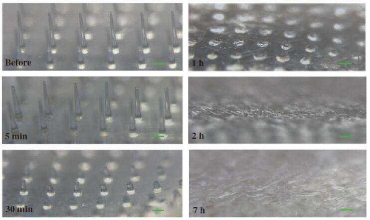 Dissolving Microneedling Beauty Patch