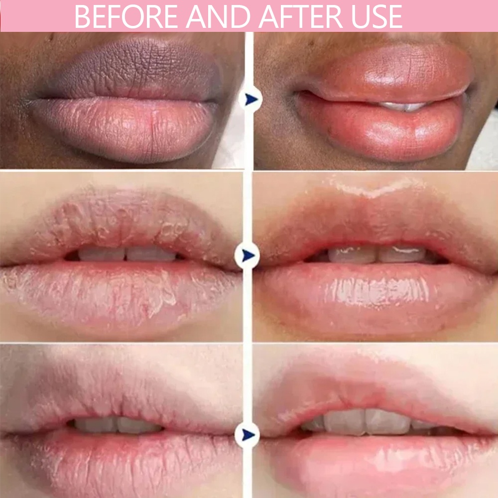 Lip Care