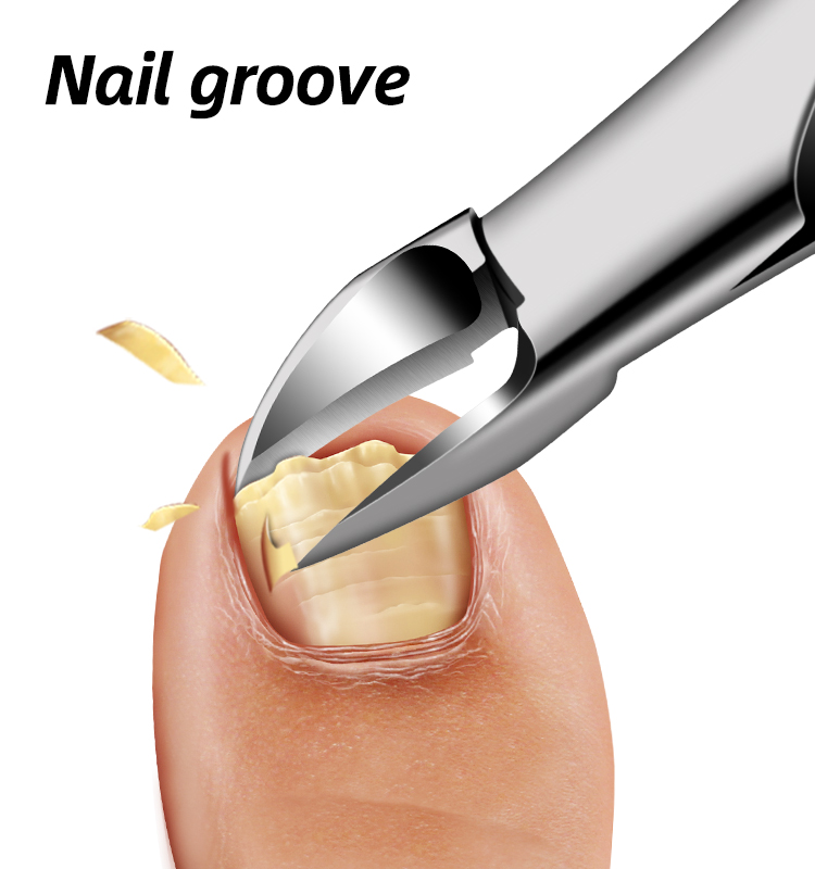 Dead skin/nail groove forceps