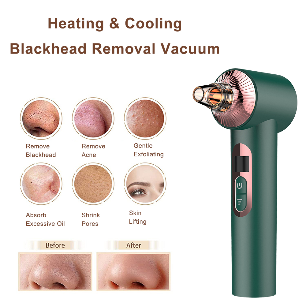Blackhead Removal