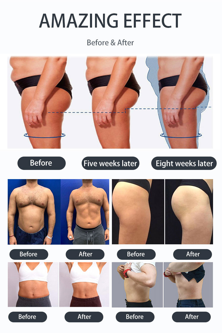 6.Weight loss&body slimming& EMS Muscle Sculptin