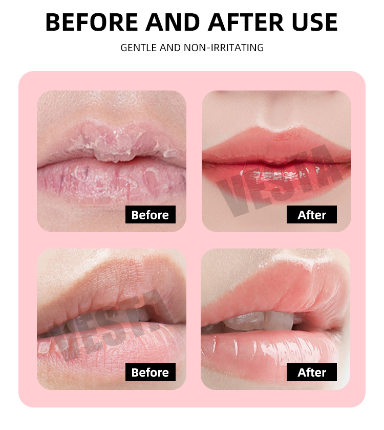 Lips care