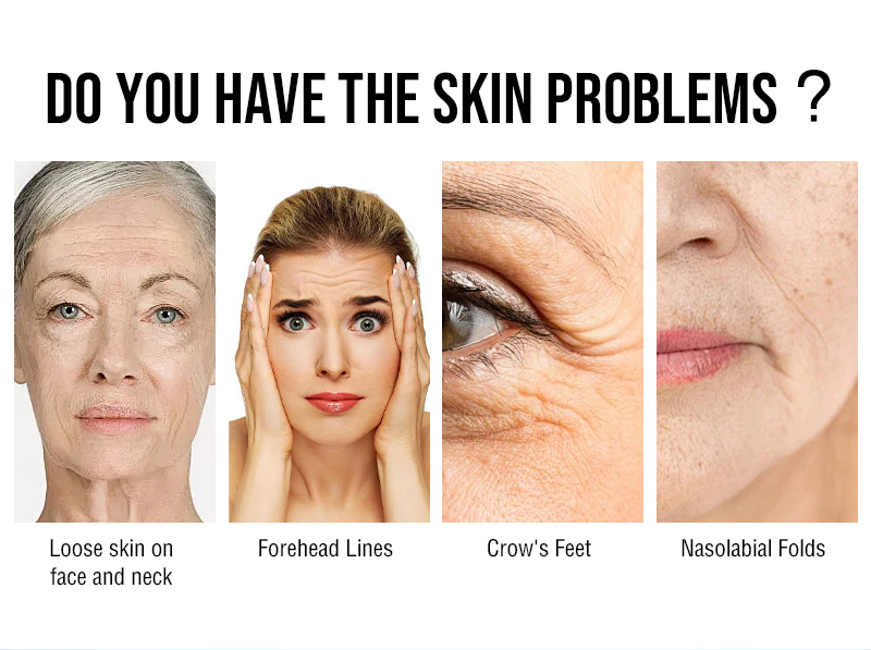 1470nm Laser Wrinkle Removal Machine