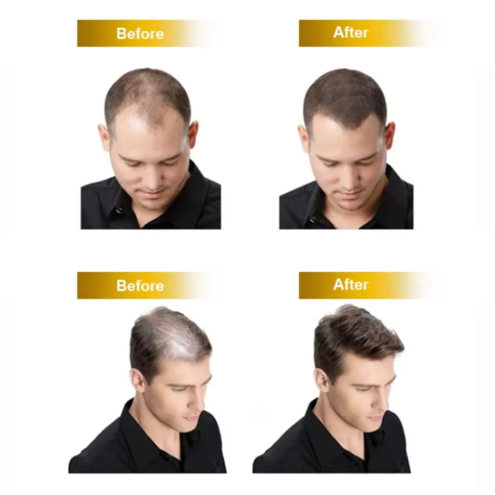 头发、皮肤和指甲